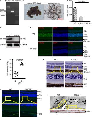 Suppressor of Cytokine Signaling 2 Regulates Retinal Pigment Epithelium Metabolism by Enhancing Autophagy